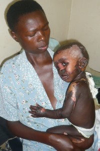 Missione Uganda Interplast Italy