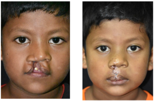 Missione Nepal 3ionlus